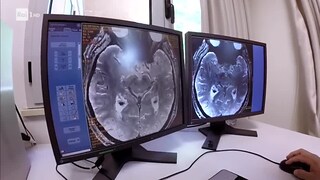 Come vede il cervello 13/08/2018 - RaiPlay